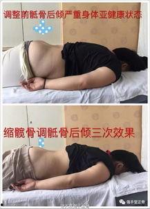 骨盆修复视频,重塑盆底健康，轻松恢复产后美丽