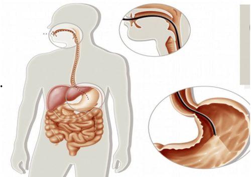 胃镜怎么做的过程视频,直观视频带你了解每一步