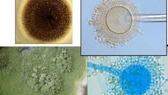 微生物视频,视频揭秘微生物的神奇与力量