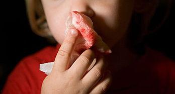 流鼻血的视频,揭秘流鼻血瞬间