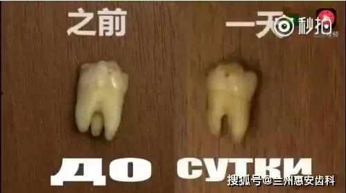 烂牙视频,口腔健康问题不容忽视