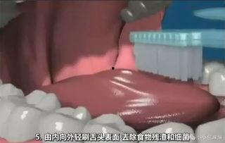 烂牙视频,口腔健康问题不容忽视