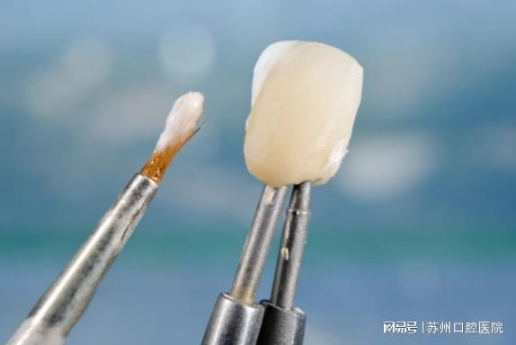 烤瓷牙视频,视频带你了解每一环节