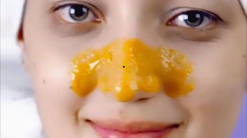 黑头 视频,深度解析皮肤问题与解决方案