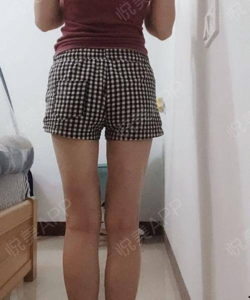 瘦大腿视频,跟随热门视频教程，告别大象腿