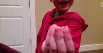 拨牙视频,拨牙手术全过程揭秘