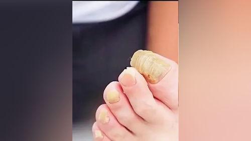 修脚的视频,跟随视频学习专业修脚技巧